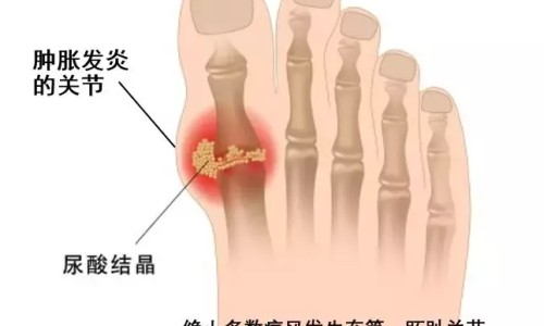 百令片一次吃4片少吗-百令片说明书一次吃五片网 :分享百令片一次吃几片效果最好-百令片为啥有吃5片呢知识